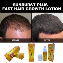Новое обновление 100% натуральные продукты для роста волос Sunburst Plus Лосьон для роста волос 100 мл для быстрого противодействия выпадению волос